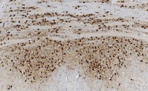 Anti-Calretinin Antibody, clone 6B8.2 ZooMAb� Mouse Monoclonal 