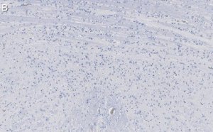 Anti-Calretinin Antibody, clone 6B8.2 ZooMAb� Mouse Monoclonal 