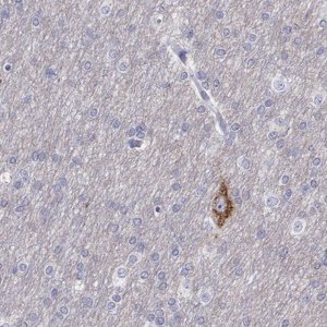 Anti-CALY antibody produced in rabbit 