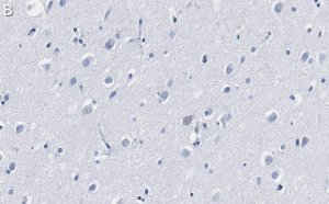 Anti-CaM Kinase II Antibody, clone 1C20 ZooMAb� Rabbit Monoclonal 