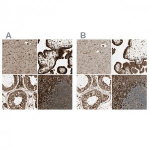 Anti-CANX antibody produced in rabbit 