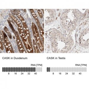 Anti-CASK antibody produced in rabbit HPA023857-100UL