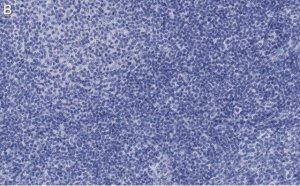 Anti-Caspase-1 p10 Antibody, clone 9H11 ZooMAb� Rabbit Monoclonal 