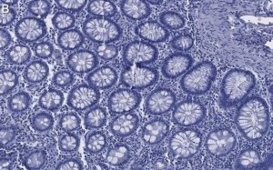 Anti-Caspase-8 Antibody, clone 1L15 ZooMAb� Rabbit Monoclonal 