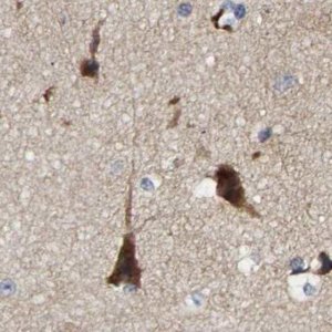 Anti-CCDC155 antibody produced in rabbit 