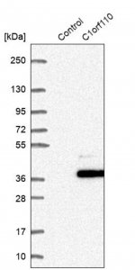 Anti-CCDC190 antibody produced in rabbit HPA028579-100UL