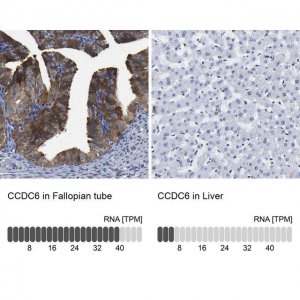 Anti-CCDC6 antibody produced in rabbit 