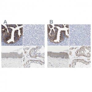 Anti-CCDC6 antibody produced in rabbit 