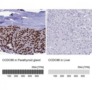 Anti-CCDC86 antibody produced in rabbit 