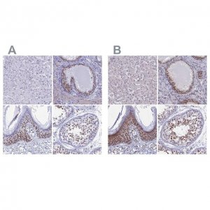 Anti-CCDC86 antibody produced in rabbit 