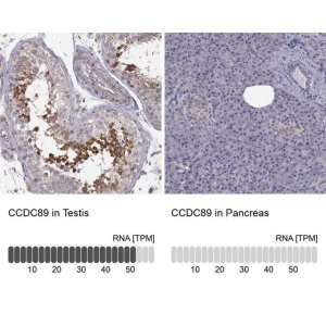 Anti-CCDC89 antibody produced in rabbit 