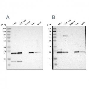 Anti-CCDC90B antibody produced in rabbit 