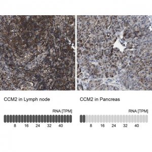 Anti-CCM2 antibody produced in rabbit 