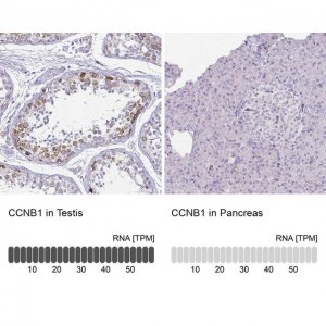 Anti-CCNB1 antibody produced in rabbit 