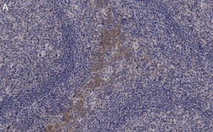 Anti-CCR2 Antibody, clone 5K5-3 ZooMAb� Rabbit Monoclonal 