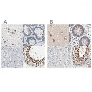 Anti-CCT5 antibody produced in rabbit 
