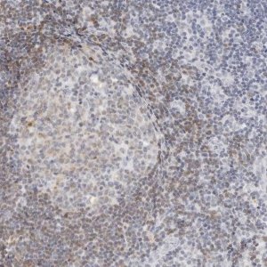 Anti-CD22 antibody produced in rabbit 