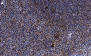 Anti-CD25 (IL2-RA) Antibody, clone 1K6 ZooMAb� Rabbit Monoclonal 