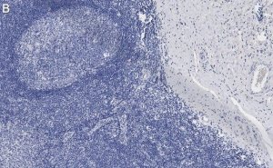 Anti-CD31 Antibody, clone 4E20 , ZooMAb� Rabbit Monoclonal 