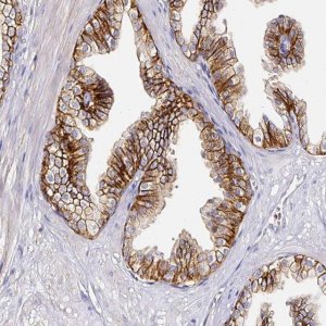 Anti-CD47 antibody produced in rabbit 