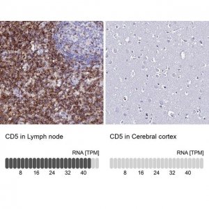 Anti-CD5 antibody produced in rabbit 