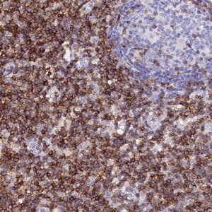 Anti-CD5 antibody produced in rabbit 