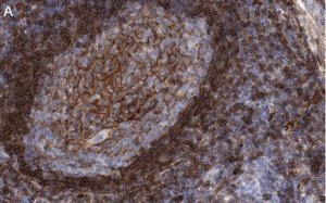 Anti-CD73 (NT5E) Antibody, clone 1F22 ZooMAb� Rabbit Monoclonal 