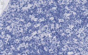Anti-CD8 Antibody, clone 1H21 ZooMAb� Rabbit Monoclonal 