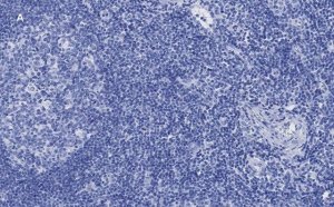 Anti-CD8a Antibody, clone 1B19, ZooMAb� Rabbit Monoclonal 
