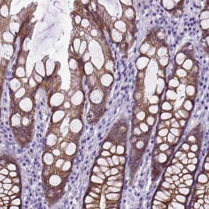 Anti-CDH1 antibody produced in rabbit 