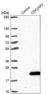 Anti-CDK2AP2 antibody produced in rabbit 