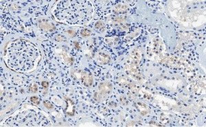 Anti-CDK6 Antibody, clone 2J3 ZooMAb� Rabbit Monoclonal 