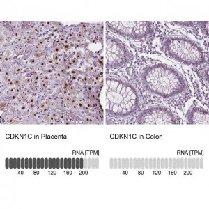 Anti-CDKN1C antibody produced in rabbit 