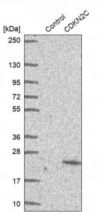 Anti-CDKN2C antibody produced in rabbit 