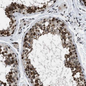 Anti-CDR2 antibody produced in rabbit 