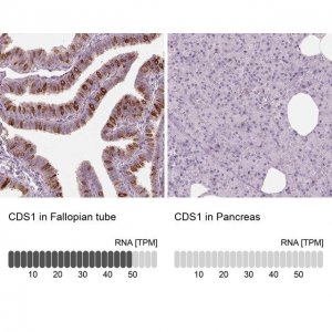 Anti-CDS1 