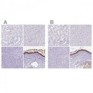 Anti-CDSN antibody produced in rabbit 