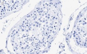 Anti-Centrin Antibody, clone 20H5 ZooMAb� Mouse Monoclonal 