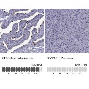 Anti-CFAP53 