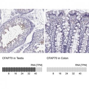 Anti-CFAP70 