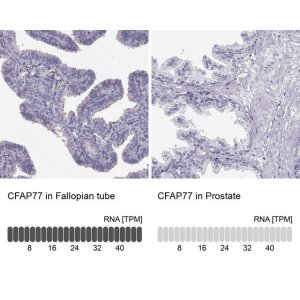 Anti-CFAP77 