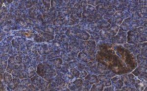 Anti-CFTR Antibody, clone 1C22 ZooMAb� Rabbit Monoclonal 