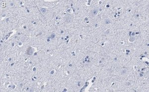 Anti-CGRP-1 Antibody, clone 2E18 ZooMAb� Rabbit Monoclonal 