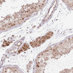 Anti-CHD1 antibody produced in rabbit 