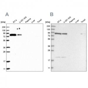 Anti-CHML antibody produced in rabbit HPA029627-100UL