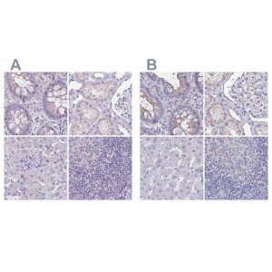 Anti-CHMP5 antibody produced in rabbit 