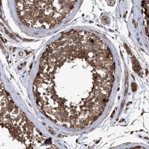 Anti-CHMP6 antibody produced in rabbit 