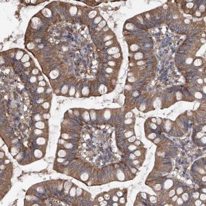 Anti-CHPF antibody produced in rabbit 