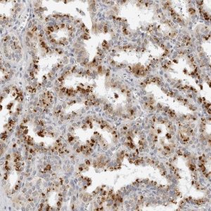 Anti-CIART antibody produced in rabbit HPA027515-100UL