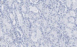 Anti-Claudin 6 Antibody, clone 1B22 ZooMAb� Rabbit Monoclonal 